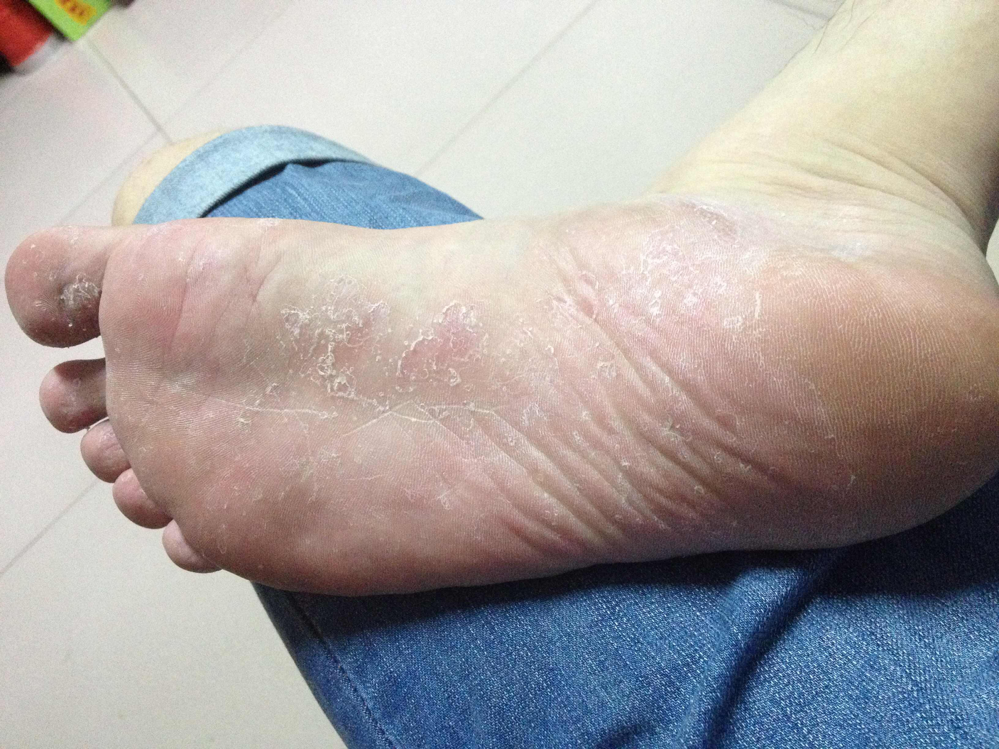 吉林省高考优秀作文,脚底板脱皮痒,功夫熊猫2