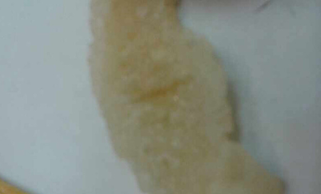 世茂大娘水饺里面吃到<em>虫子</em>和<em>头发丝</em> 服务员竟